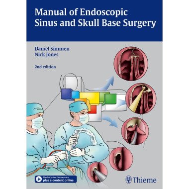 Manual of Endoscopic Sinus Surgery Daniel